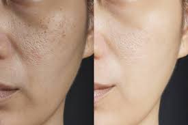 Medicube Collagen Overnight Wrapping Mask